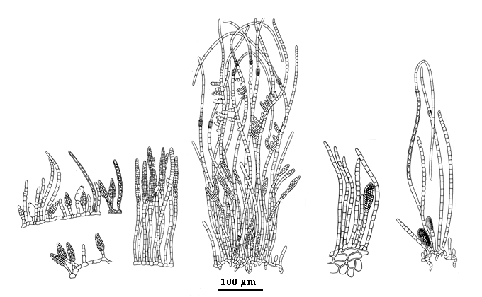 drawing of Compsonema fructuosum