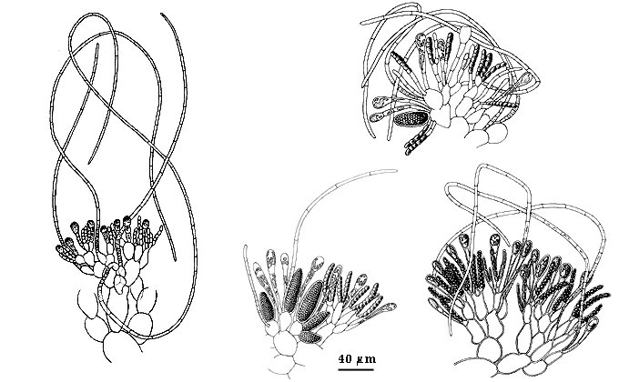 drawing of Leathesia difformis