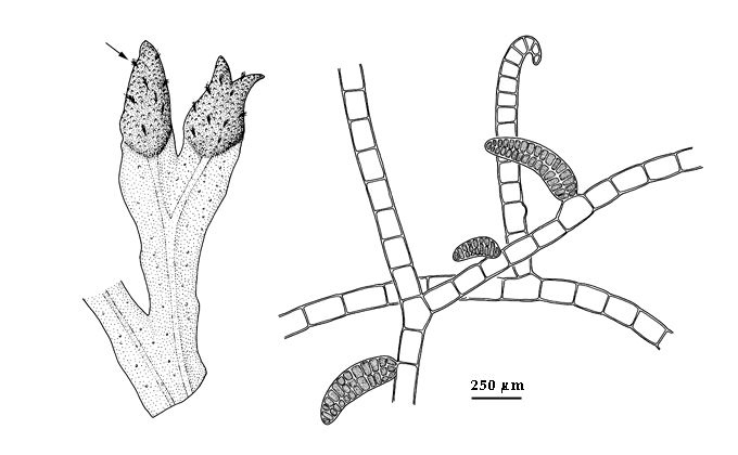  drawing of Spongonema tomentosum 